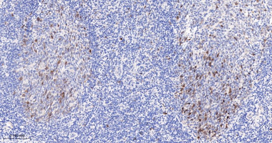 CCNA2 Recombinant Rabbit mAb(b
