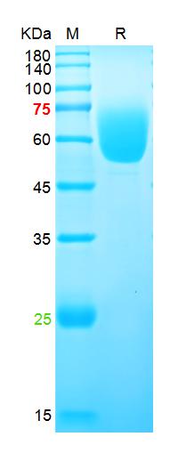 Recombinant human AXL protein,