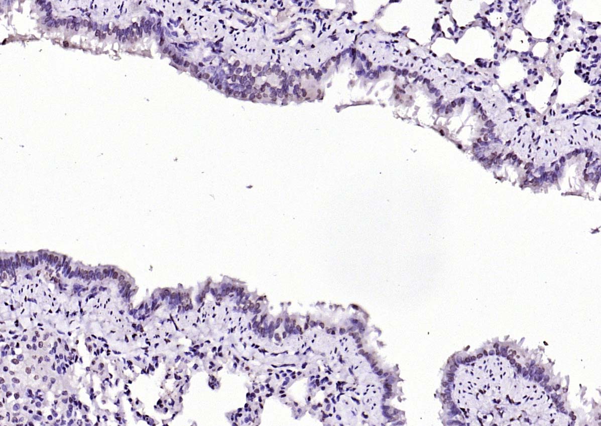 SIK1 Rabbit pAb(bs-6252R)-50ul