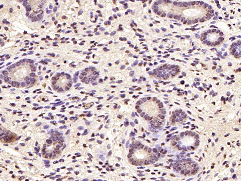 Cyclin D1 Rabbit pAb(bs-20596R