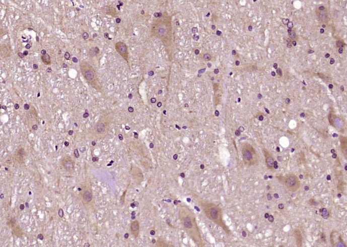 RTN1 Rabbit pAb(bs-11798R)-50u