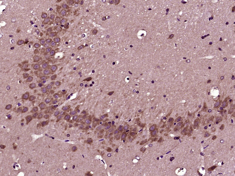 RBM33 Rabbit pAb(bs-21295R)-50