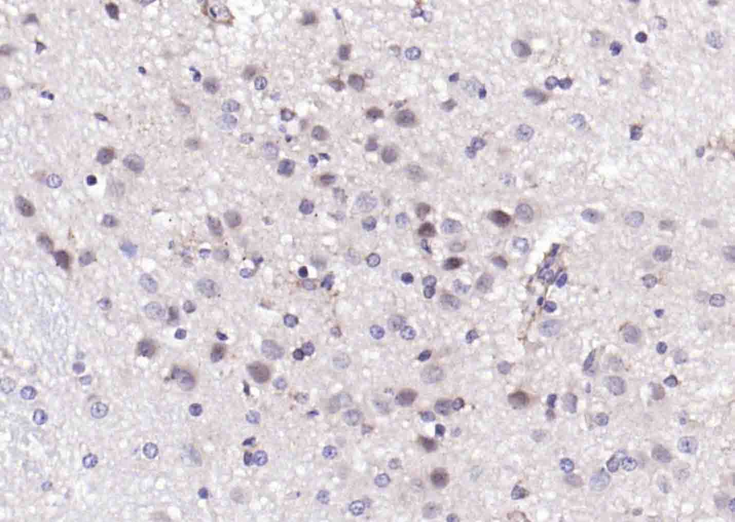 PIK3R2 Rabbit pAb(bs-4160R)-50