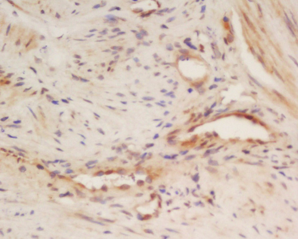 CALU Rabbit pAb(bs-6658R)-50ul