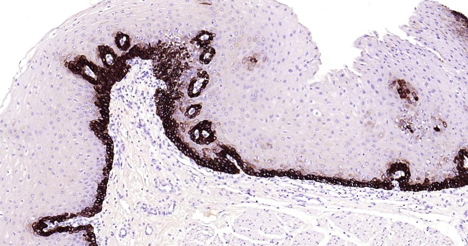 Cytokeratin 14 Recombinant Rab