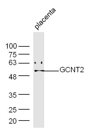 GCNT2 Rabbit pAb(bs-13316R)-50
