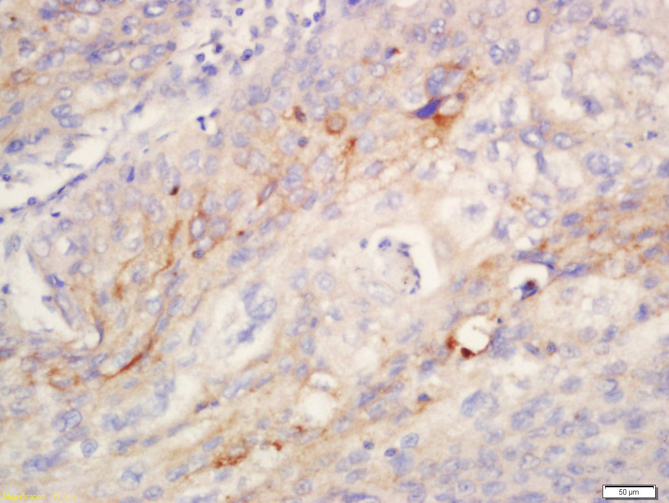 ANO1/DOG1 Rabbit pAb(bs-3794R)