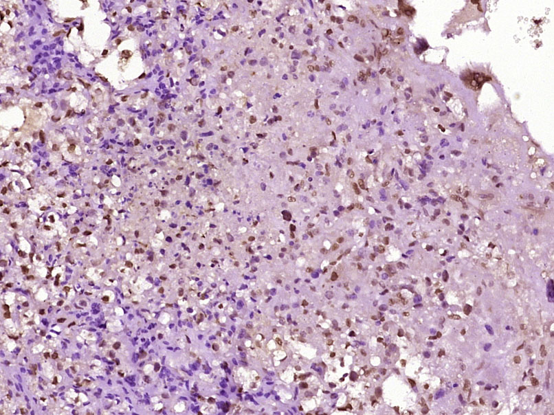 BRMS1 Rabbit pAb(bs-8686R)-50u