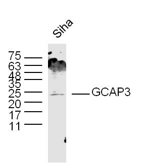 GCAP3 Rabbit pAb(bs-13308R)-50