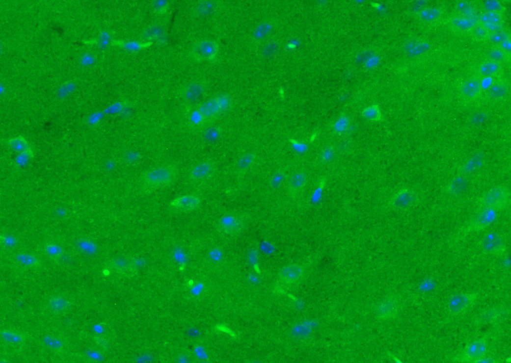 Phospholipase C beta 2 Rabbit 