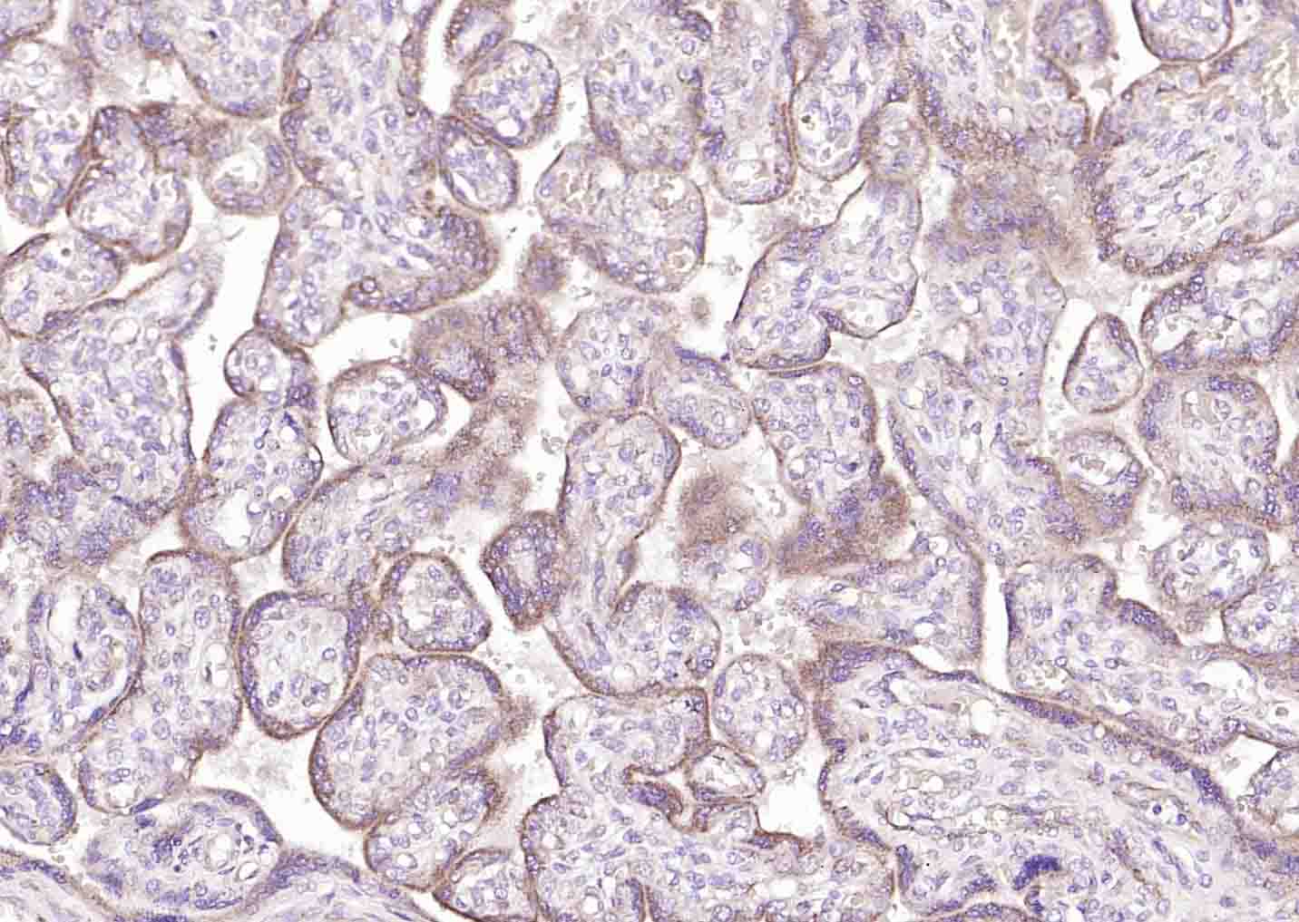 ACKR3 Rabbit pAb(bs-4897R)-50u