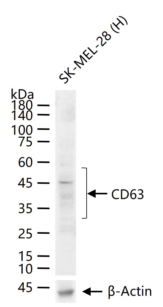 CD63 Rabbit pAb(bs-1523R)-50ul
