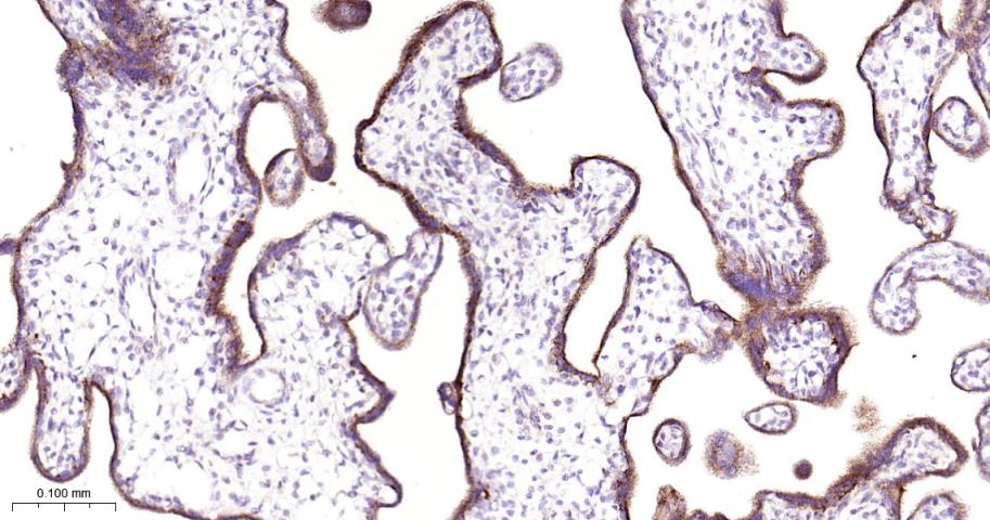 GBA Recombinant Rabbit mAb(bsm