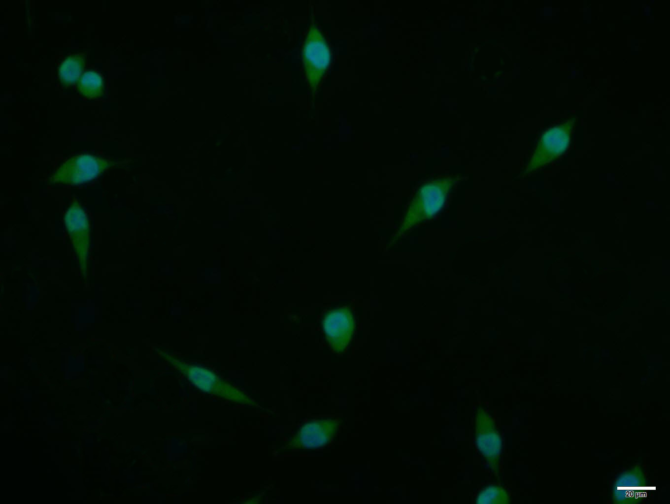 phospho-KLF5 (Ser311) Rabbit p