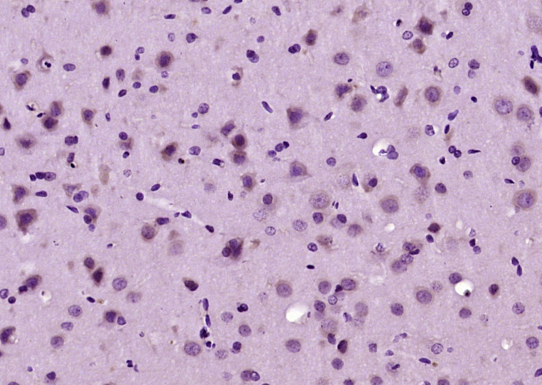 phospho-PLCG1 (Tyr783) Rabbit 