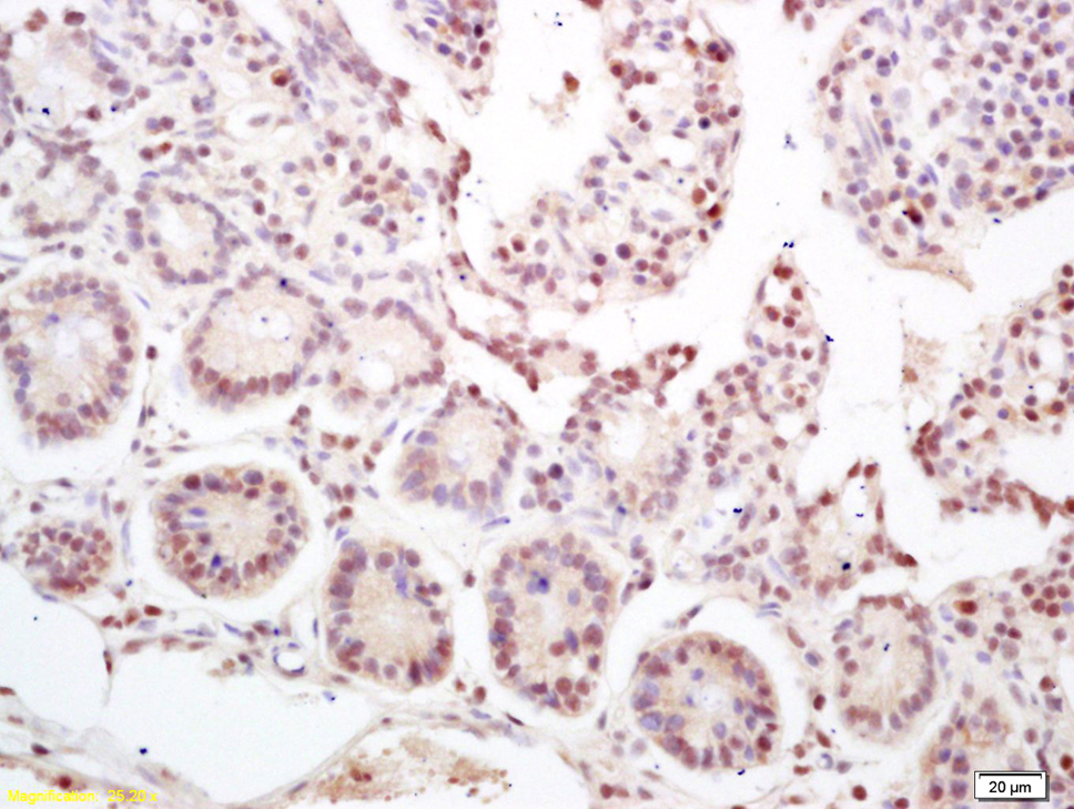 NKAP Rabbit pAb(bs-12400R)-50u