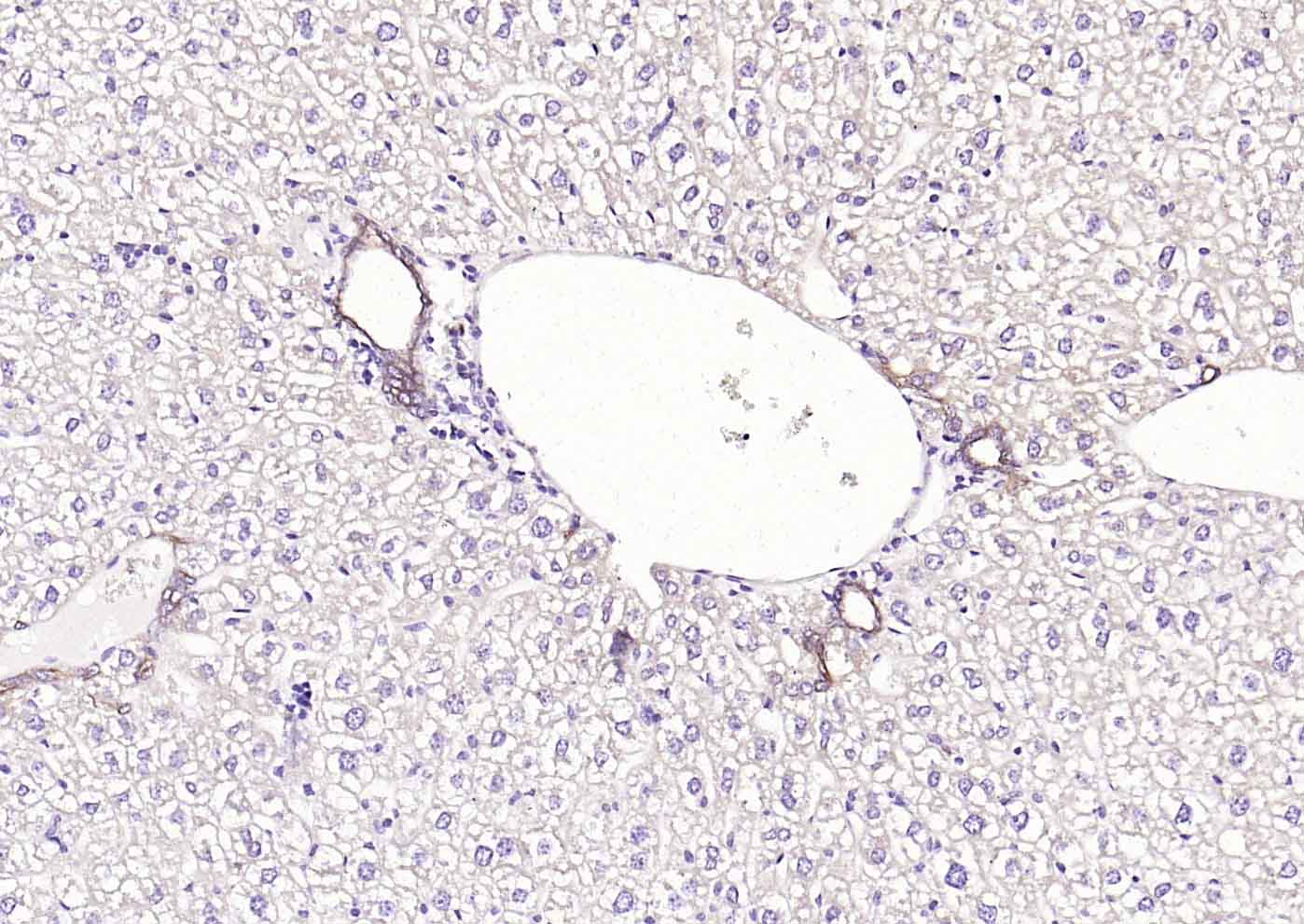 ACVRL1 Rabbit pAb(bs-6020R)-50