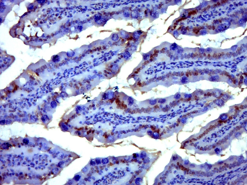 NFKB p65 (Acetyl-Lys314/Lys315