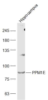 PPM1E Rabbit pAb(bs-21063R)-50