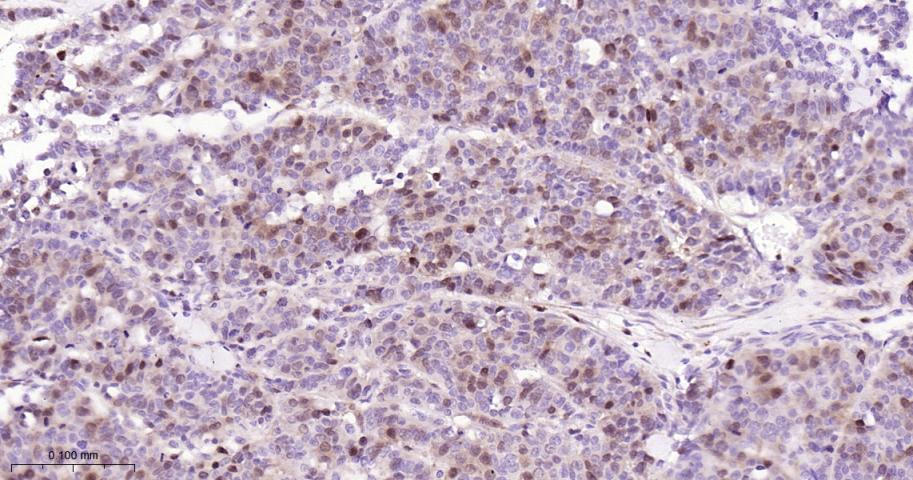 TYMS Recombinant Rabbit mAb(bs