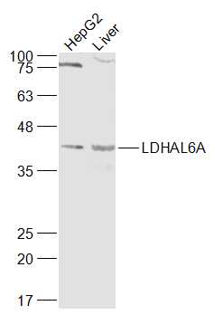LDHAL6A Rabbit pAb(bs-18205R)-