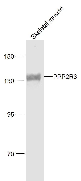 PPP2R3 Rabbit pAb(bs-5759R)-50