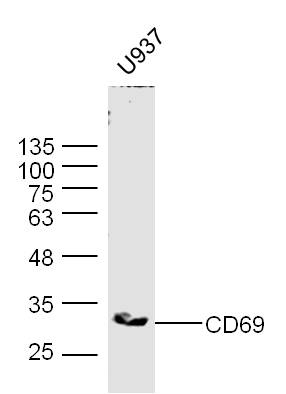 CD69 Rabbit pAb(bs-2499R)-50ul