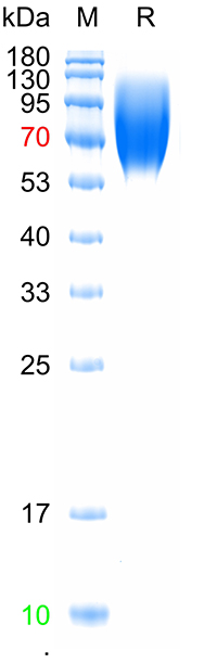 Recombinant human LAMP1 protei