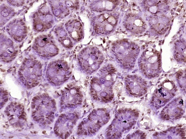 phospho-KLF5 (Ser311) Rabbit p