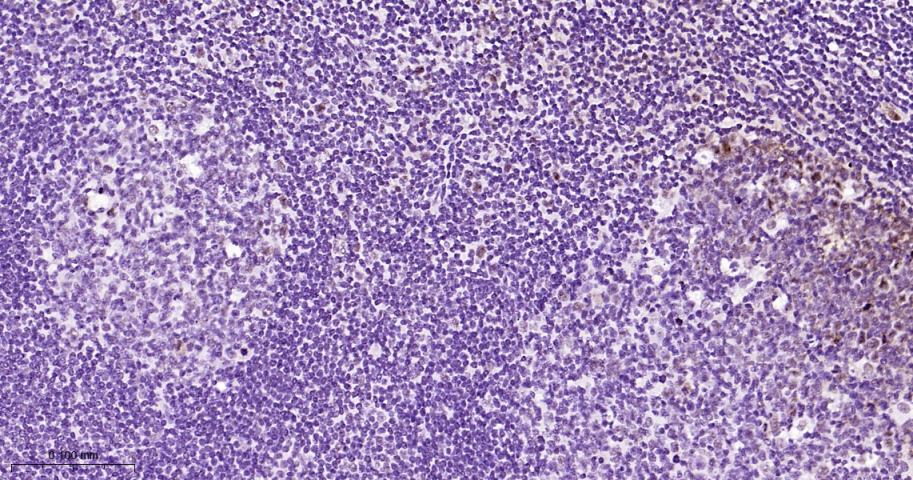 phospho-STAT3 (Tyr705) Mouse m