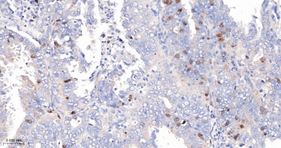 CCNA2 Recombinant Rabbit mAb(b