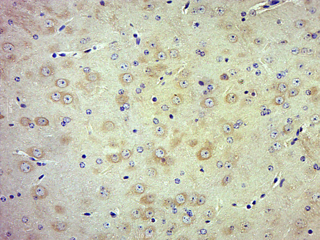 phospho-TrkB (Tyr705) Rabbit p