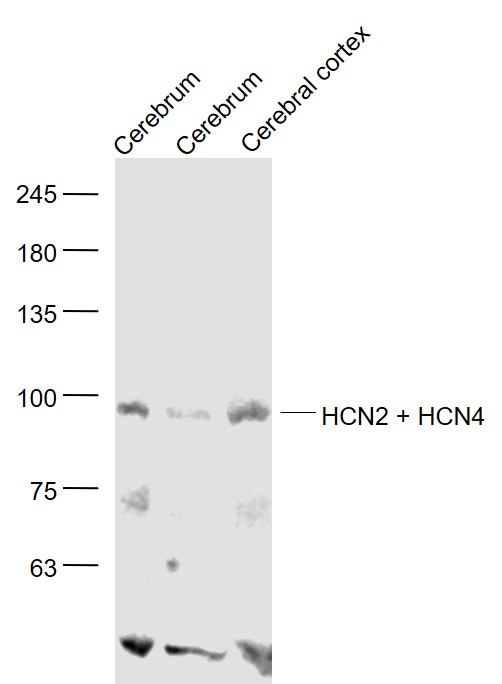HCN2 + HCN4 Rabbit pAb(bs-1163