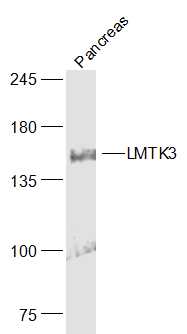 LMTK3 Rabbit pAb(bs-18317R)-50