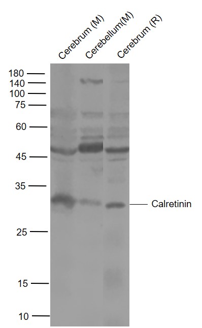 CALB2 Rabbit pAb(bs-0062R)-50u