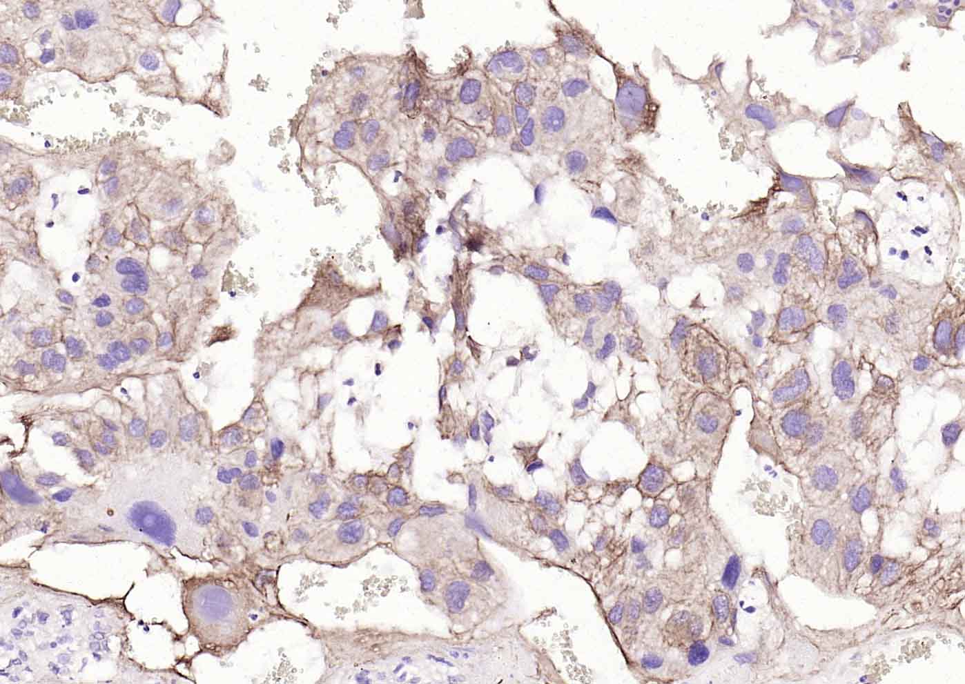 ACVRL1 Rabbit pAb(bs-6020R)-50