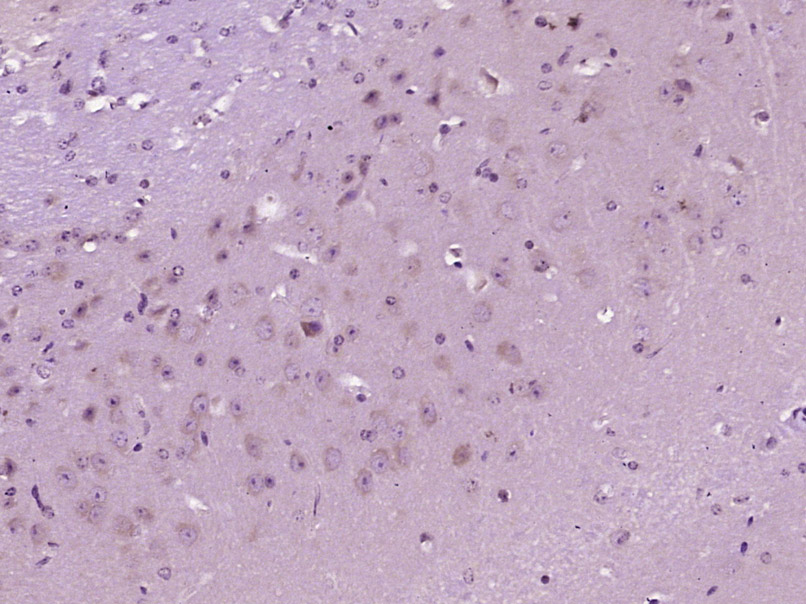 NPTX2 Rabbit pAb(bs-11017R)-50