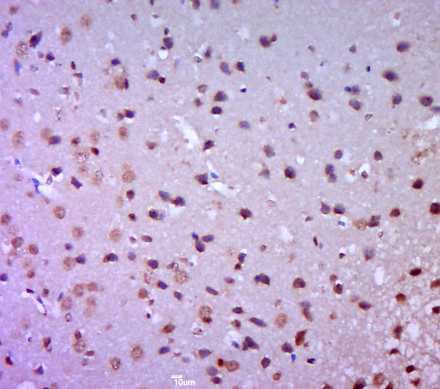 GAK Rabbit pAb(bs-16212R)-50ul