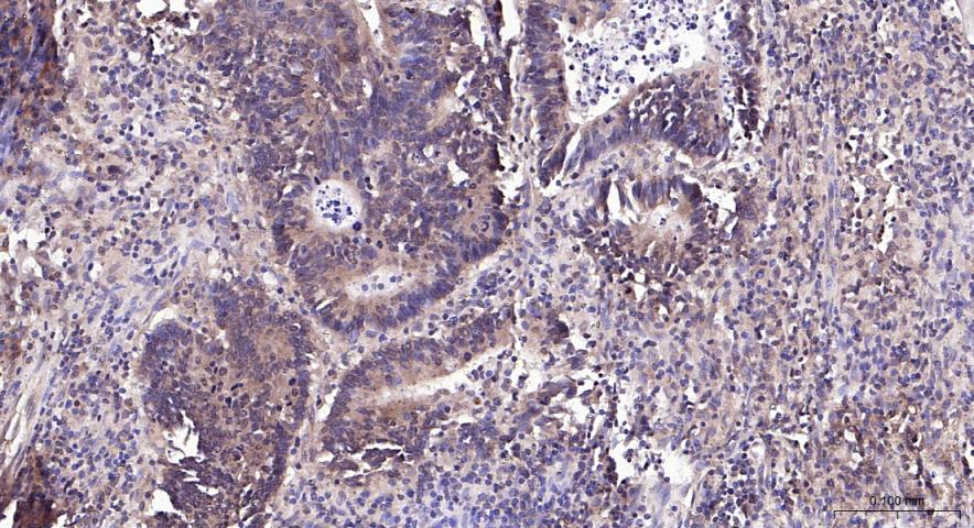 PI3 Kinase p110 beta Rabbit pA