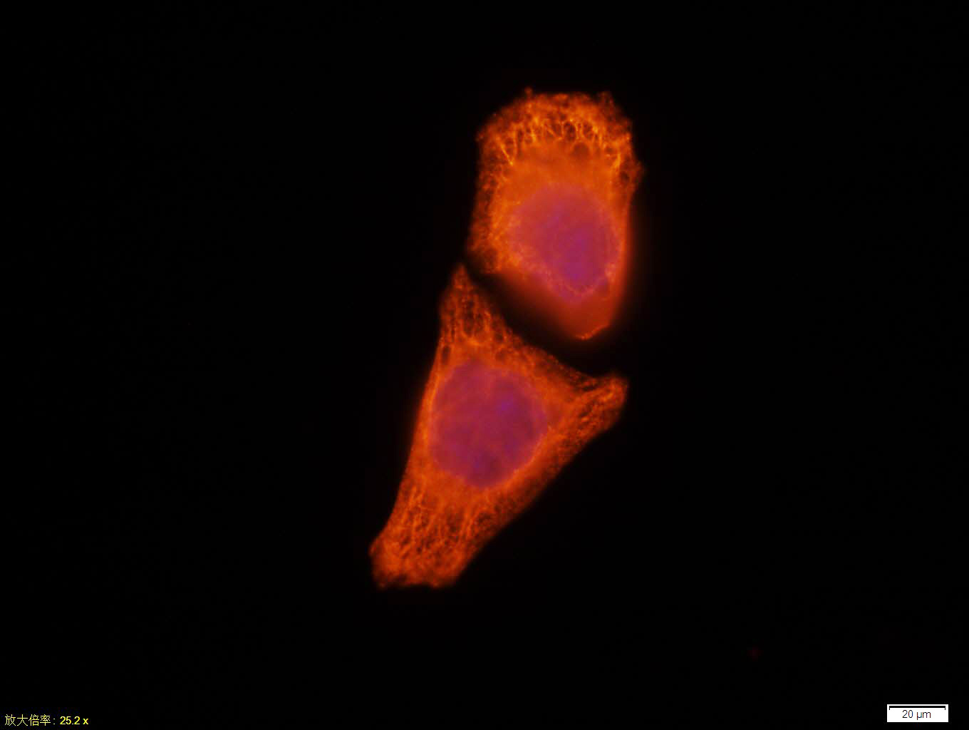 CK18 Mouse mAb(bsm-33102M)-50u