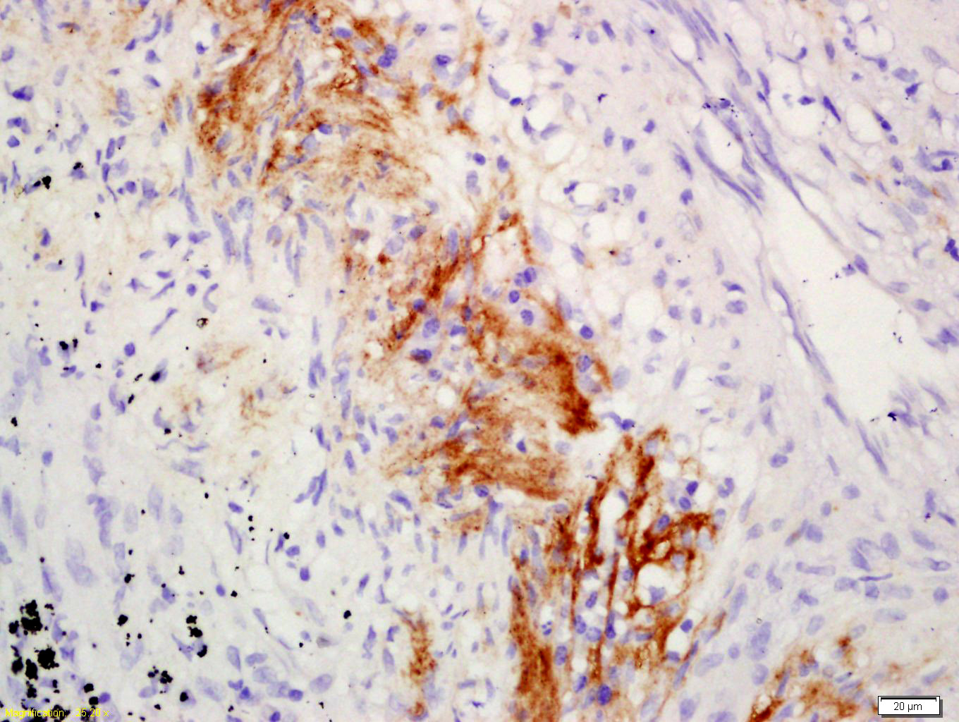 C1QA Rabbit pAb(bs-11336R)-50u