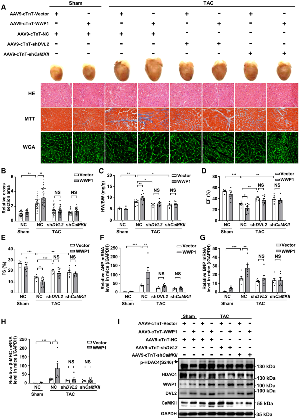 IF=23.603【AAV在心脏疾病中的应用】科学家揭示病理性心肌肥厚及心力衰竭治疗的潜在靶点