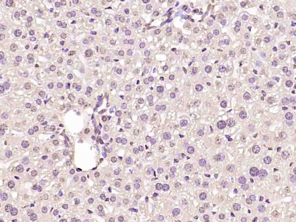 Cyclin D1 Rabbit pAb(bs-20596R