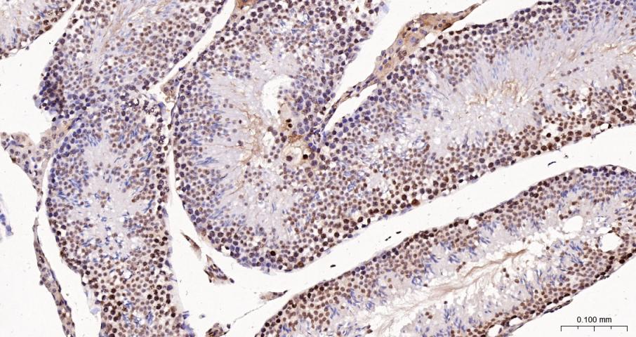 Histone H3(di methyl K27) Mous