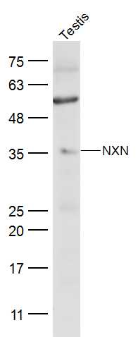 NXN Rabbit pAb(bs-19555R)-50ul
