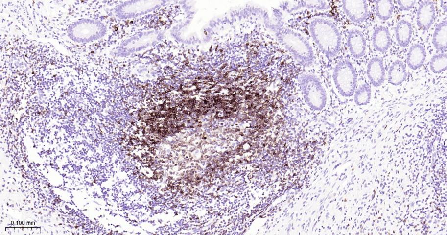CD79a Mouse mAb(bsm-33449M)-50