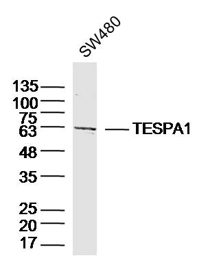 TESPA1 Rabbit pAb(bs-8623R)-50