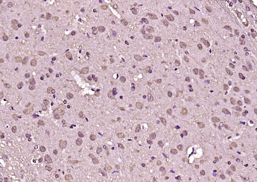 RASA1 Rabbit pAb(bs-13280R)-50