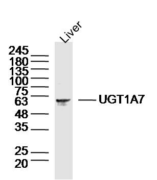 UGT1A7 Rabbit pAb(bs-20068R)-5
