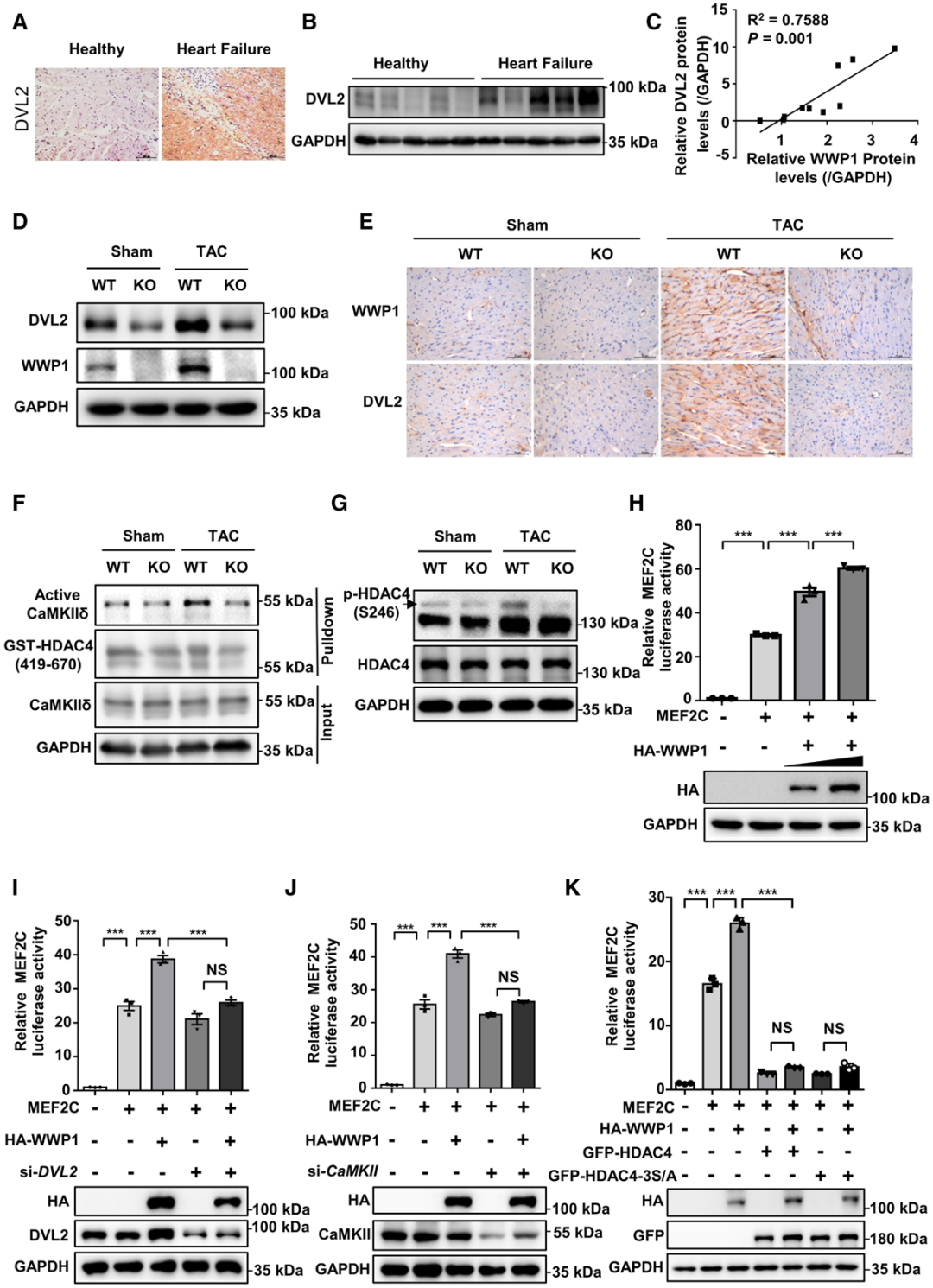 IF=23.603【AAV在心脏疾病中的应用】科学家揭示病理性心肌肥厚及心力衰竭治疗的潜在靶点
